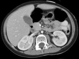May contain: ct scan, x-ray, and medical imaging x-ray film