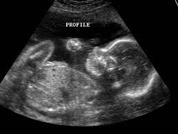 May contain: x-ray, medical imaging x-ray film, and ct scan