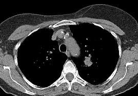 May contain: medical imaging x-ray film, x-ray, and ct scan