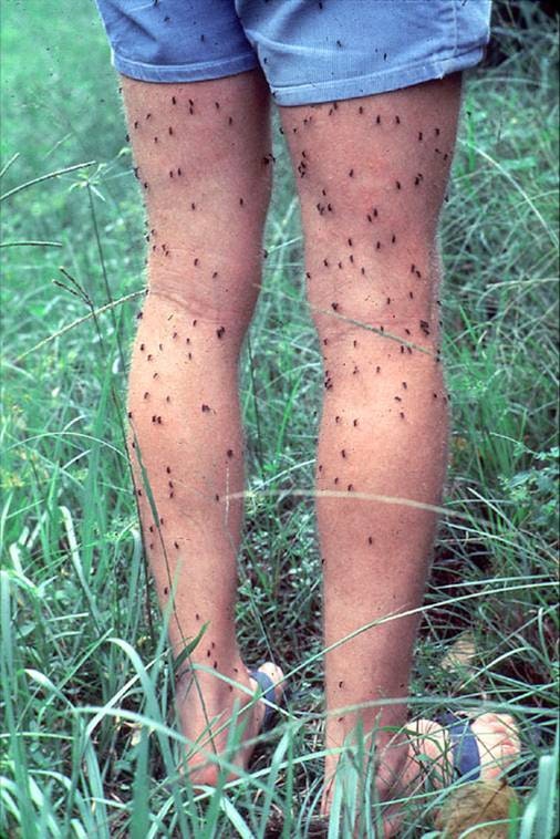 Person's legs covered in many small insects, likely mosquitoes, in a grassy area.
