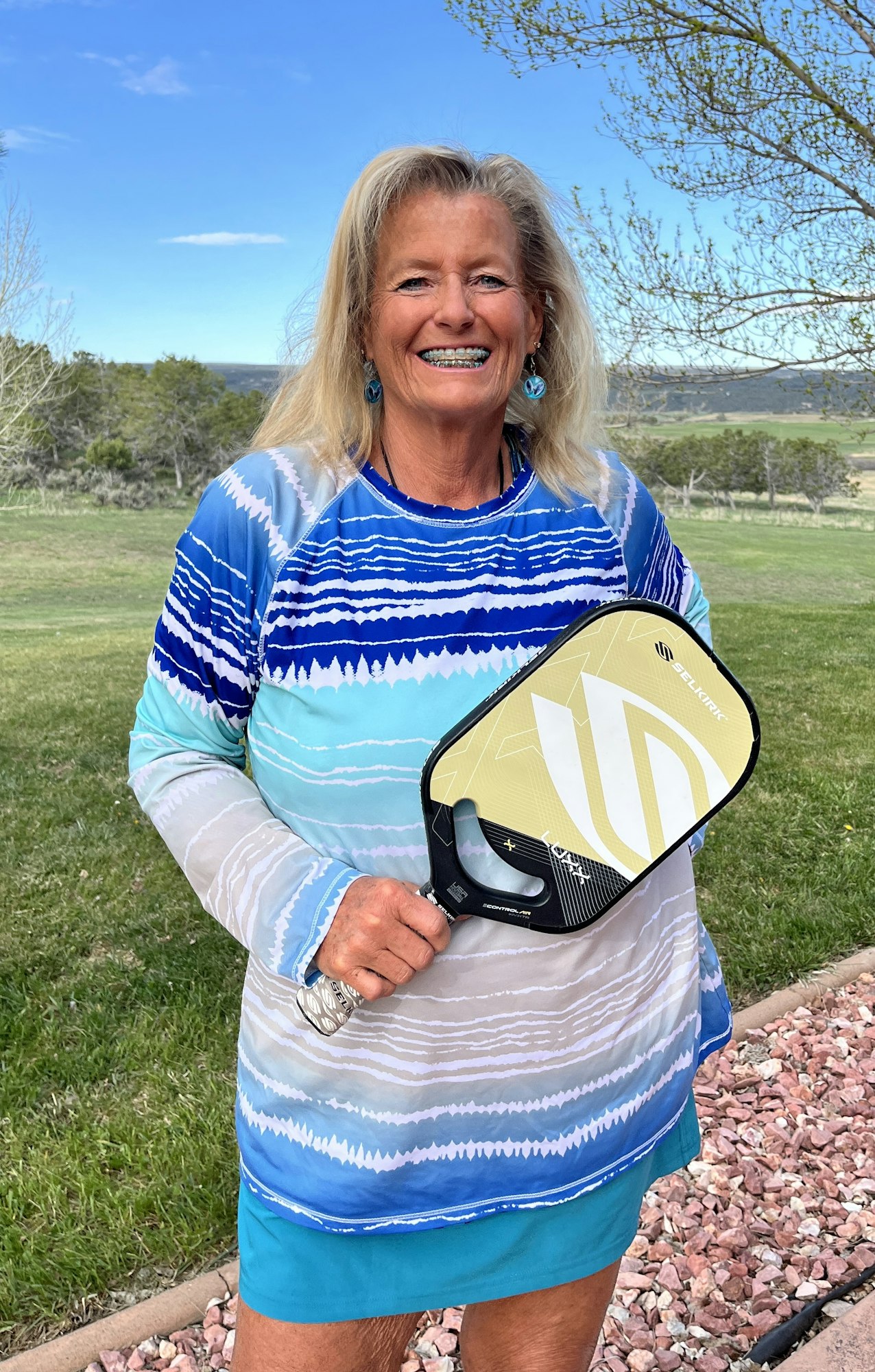 A person smiling outdoors holding a pickleball paddle, wearing a blue patterned shirt.