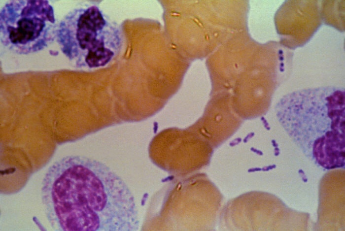 Plague_bacteria_in_blood under a microscope