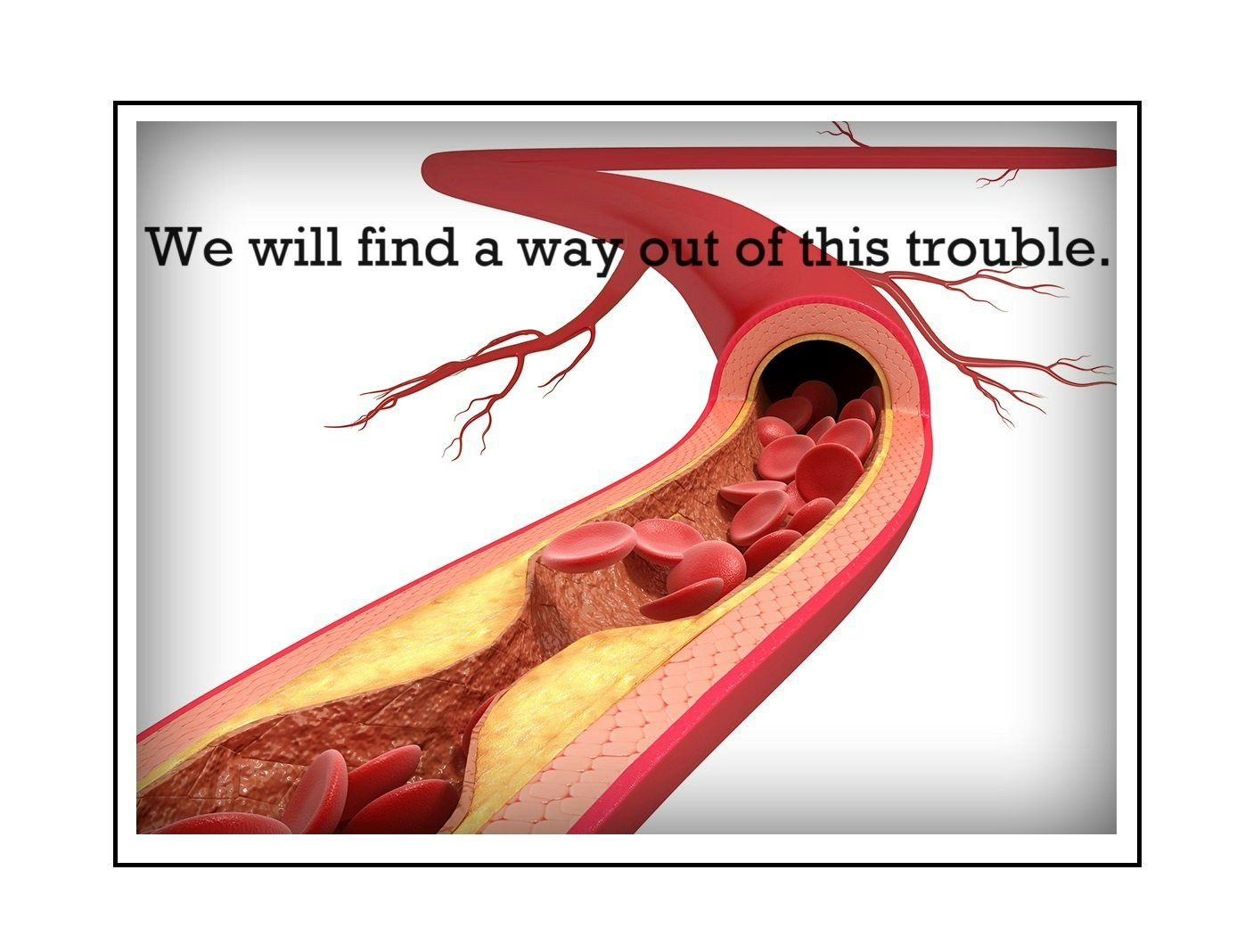 The image depicts a stylized artery with blood cells and a motivational caption about overcoming challenges.