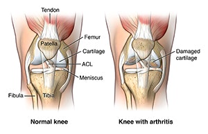 may contain knee ligaments