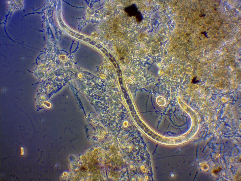 Microscopic view of a nematode among debris, possibly a soil or water sample.