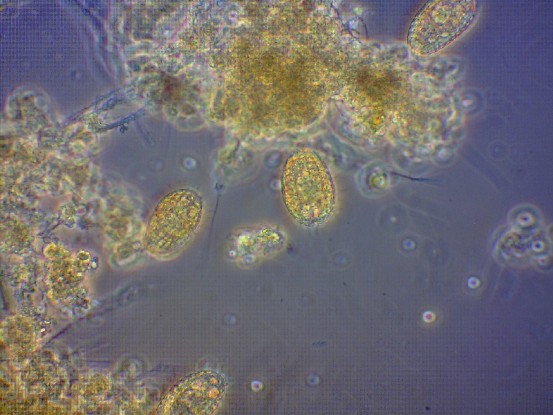 Microscopic view of cells and potentially some organic material, possibly from a pond water sample or similar environment.