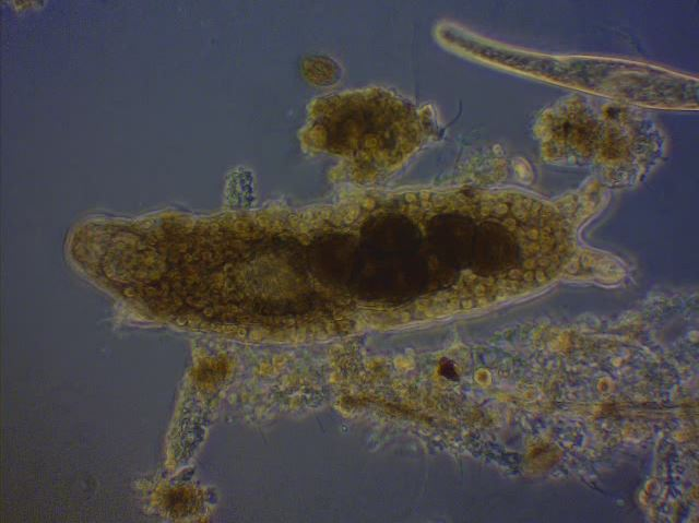 Microscopic view of a tiny organism, likely a rotifer, with internal details visible.
