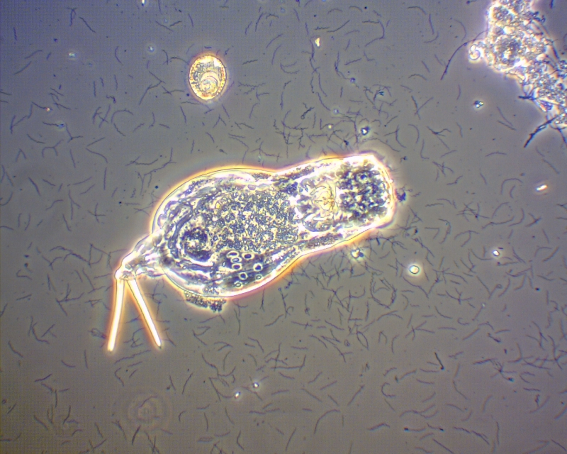 Microscopic view of a possibly parasitic organism among other small entities, possibly in a liquid medium.