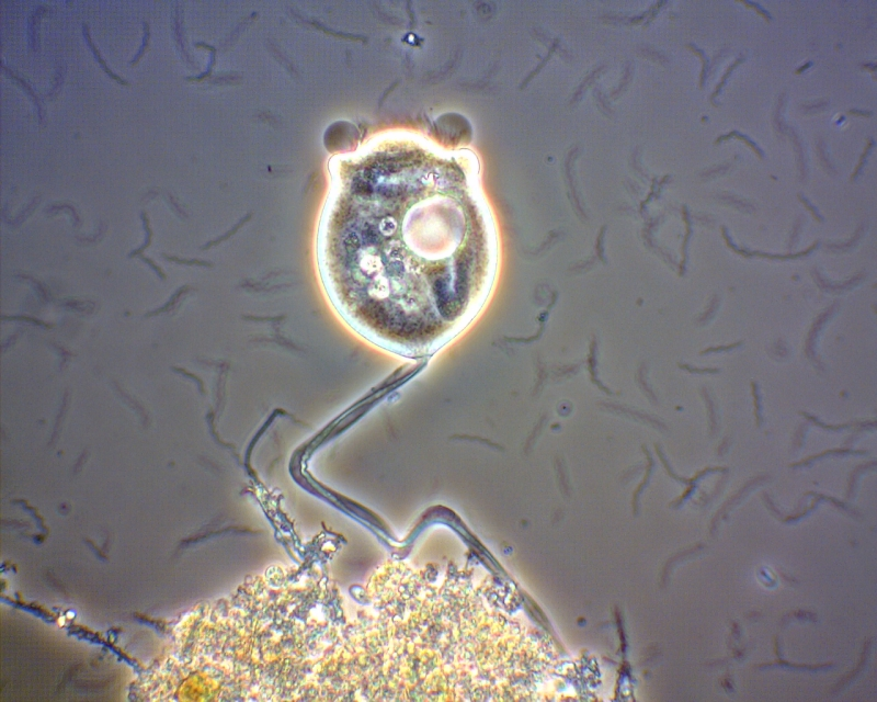 Microscopic view of a single-celled organism, possibly a protozoan, with visible internal structures.