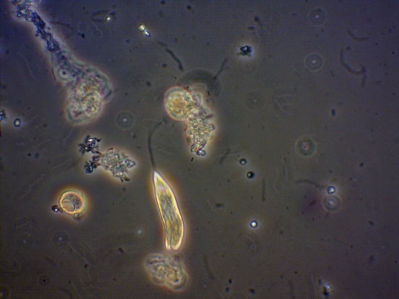 Microscopic organisms and debris; possibly a protist near the center.
