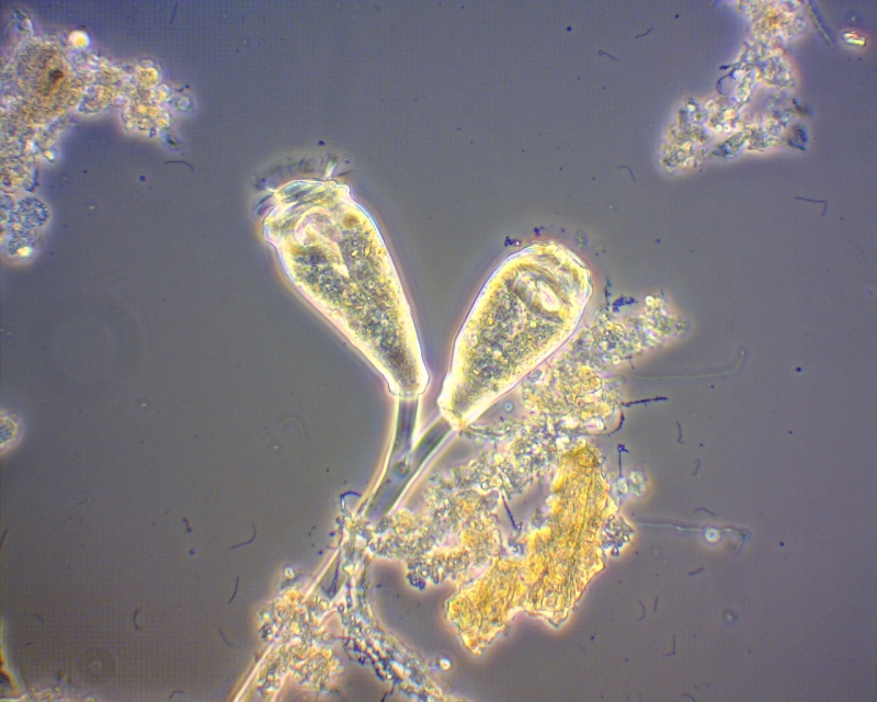 Microscopic organisms, possibly plankton, and debris under a microscope.