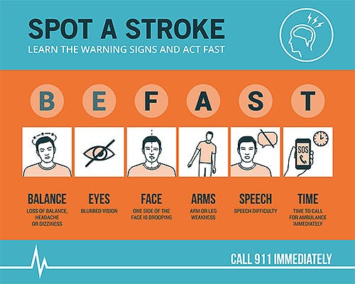 Infographic on stroke signs: BE FAST—Balance, Eyes, Face, Arms, Speech, Time. Urges calling 911 immediately.