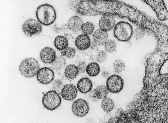 The image shows a close-up view of various virus particles captured using electron microscopy.