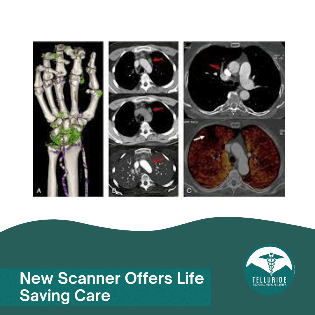 Medical scans of hand and chest, with text: "New Scanner Offers Life Saving Care," branding of Telluride Regional Medical Center.