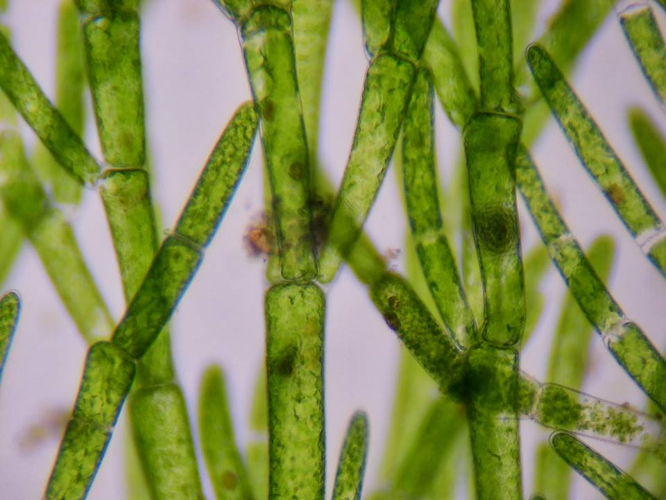Close-up view of green algae cells under a microscope, showing elongated structures and detailed cell walls.
