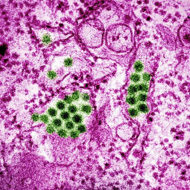 Microscopic view of viral particles with green clusters on a pink background.