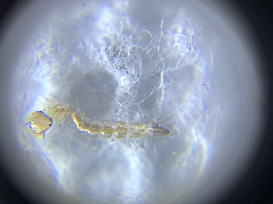 microscope image