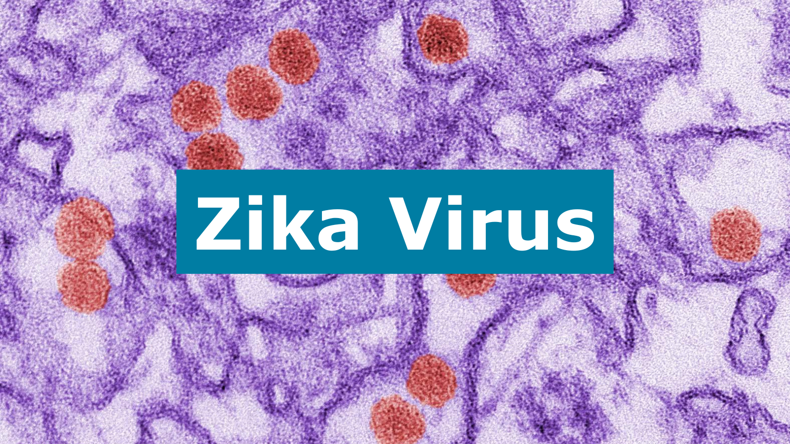 The image displays a microscopic view of the Zika virus, highlighted with orange particles against a purple background.
