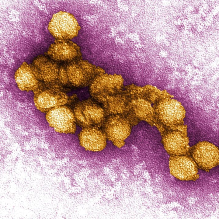 Electron microscope image showing round, golden West Nile virus particles on a pink background.