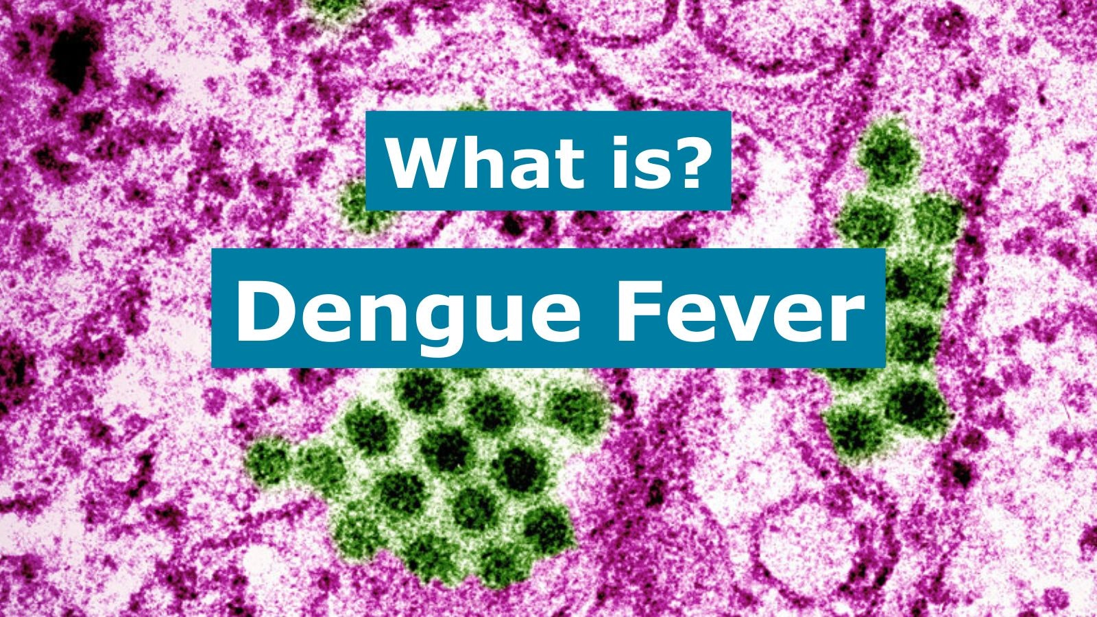 Text on a microscopic image background: "What is Dengue Fever?"